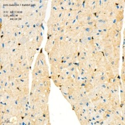 Anti-Galectin 1 Rabbit pAb
