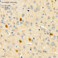 Anti-Galectin 1 Rabbit pAb