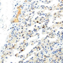 Anti-MMP9 Rabbit pAb