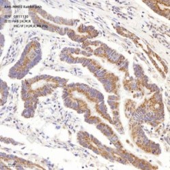 Anti-MMP2 Rabbit pAb