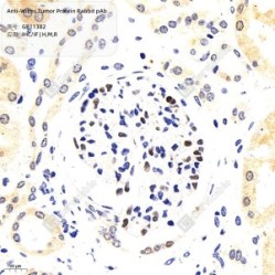 Anti-Wilms Tumor Protein Rabbit pAb