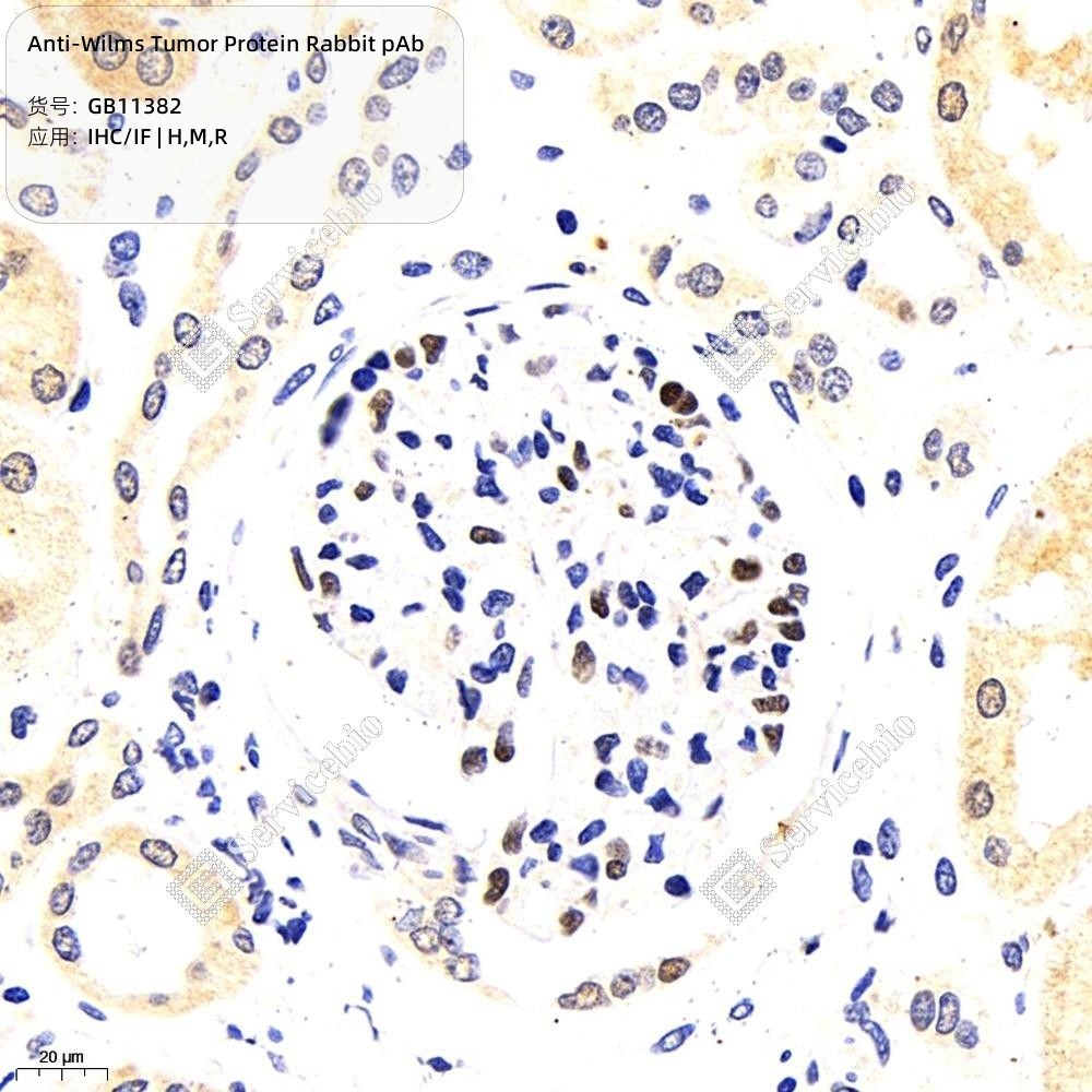 Anti-Wilms Tumor Protein Rabbit pAb
