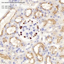 Anti-Wilms Tumor Protein Rabbit pAb