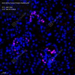 Anti-Wilms Tumor Protein Rabbit pAb