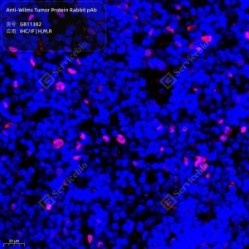 Anti-Wilms Tumor Protein Rabbit pAb