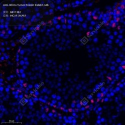 Anti-Wilms Tumor Protein Rabbit pAb