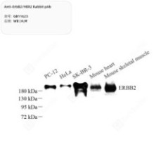 Anti-ErbB2/HER2 Rabbit pAb