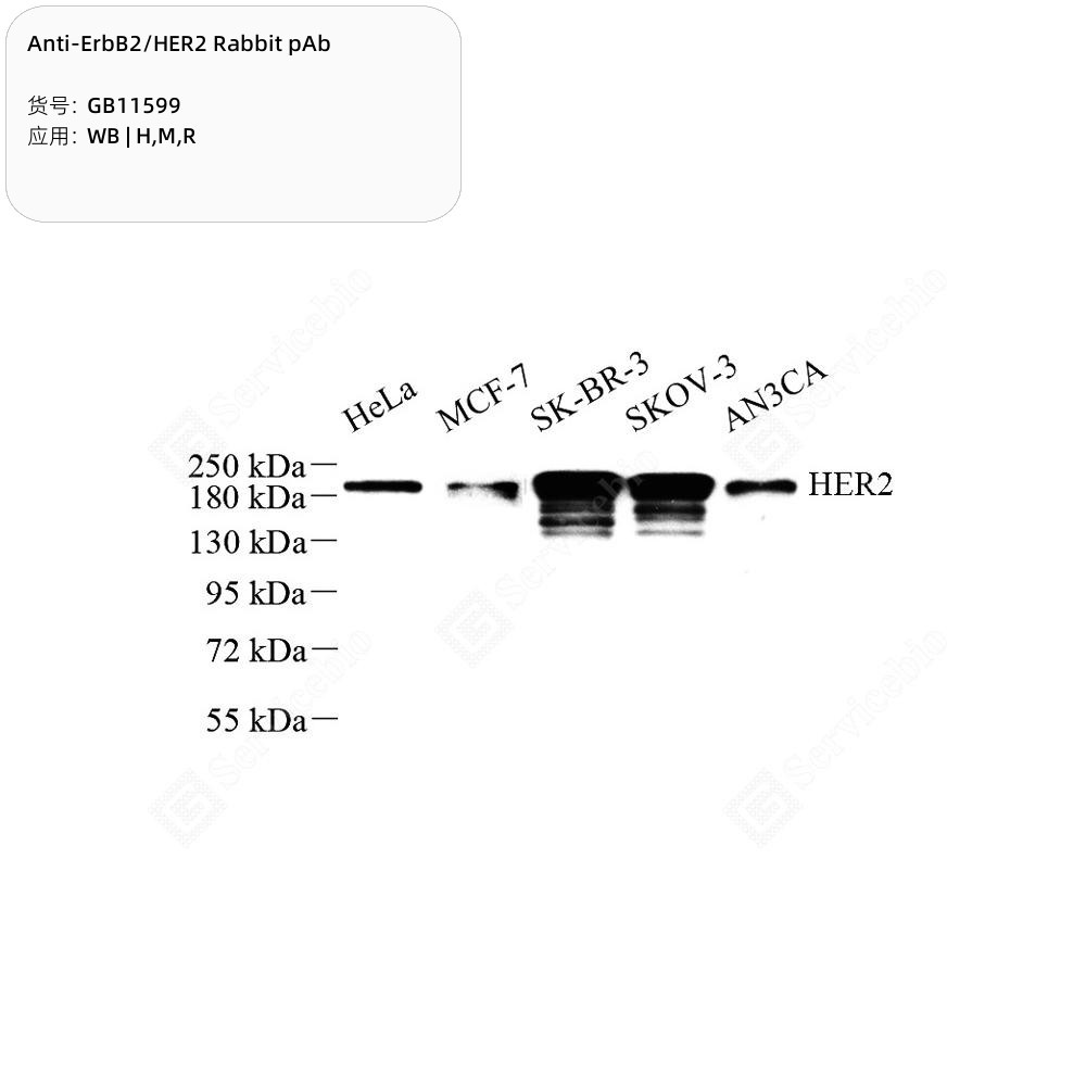 Anti-ErbB2/HER2 Rabbit pAb