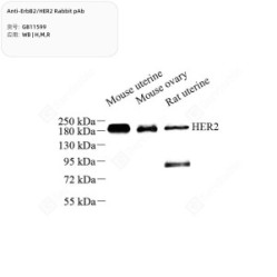 Anti-ErbB2/HER2 Rabbit pAb