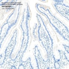 Recombinant Anti-Intestinal...