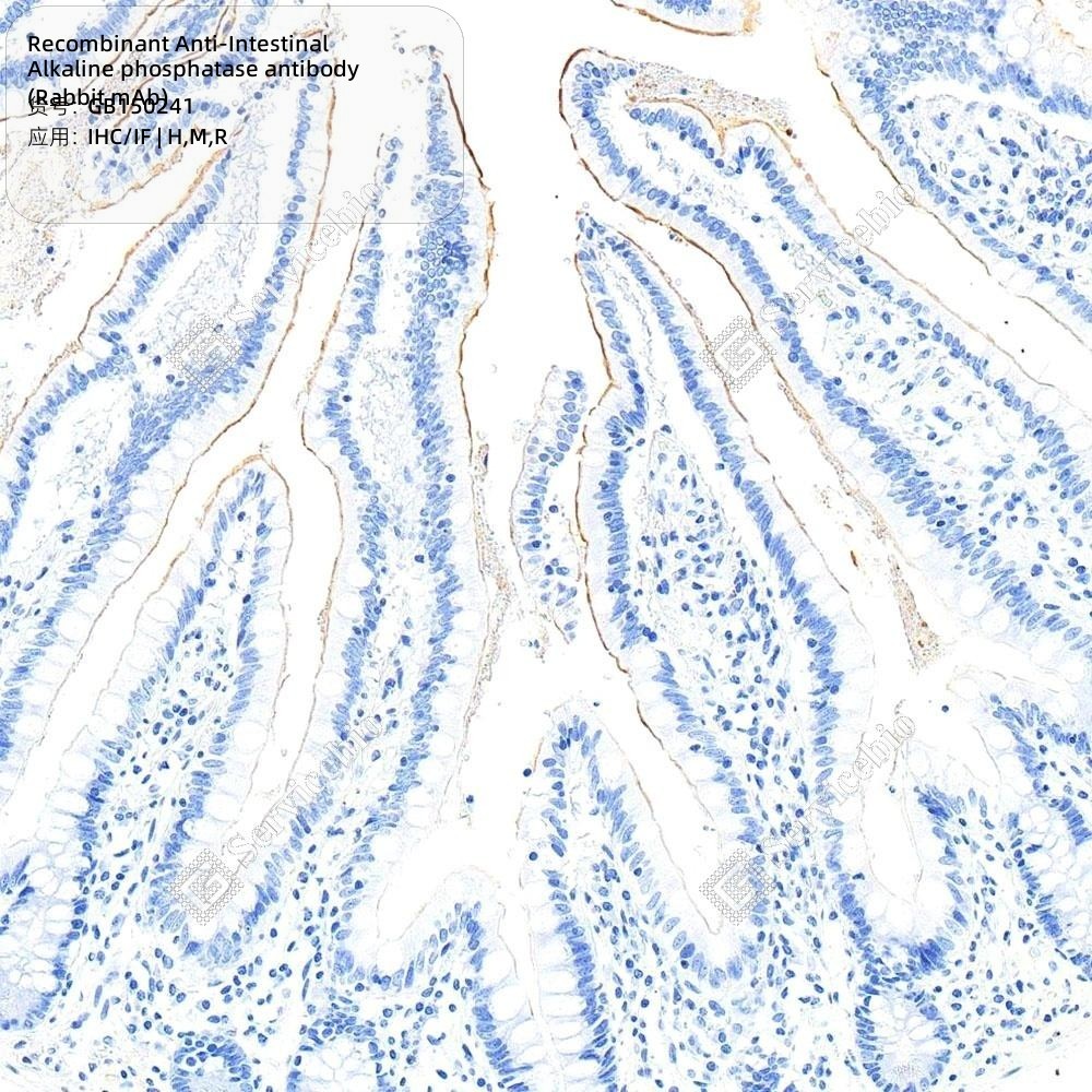 Recombinant Anti-Intestinal Alkaline phosphatase antibody (Rabbit mAb)