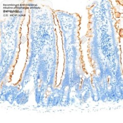 Recombinant Anti-Intestinal Alkaline phosphatase antibody (Rabbit mAb)