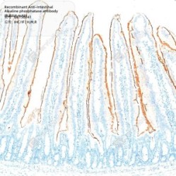 Recombinant Anti-Intestinal Alkaline phosphatase antibody (Rabbit mAb)