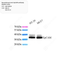 Recombinant Anti-EpCAM antibody (Rabbit mAb)
