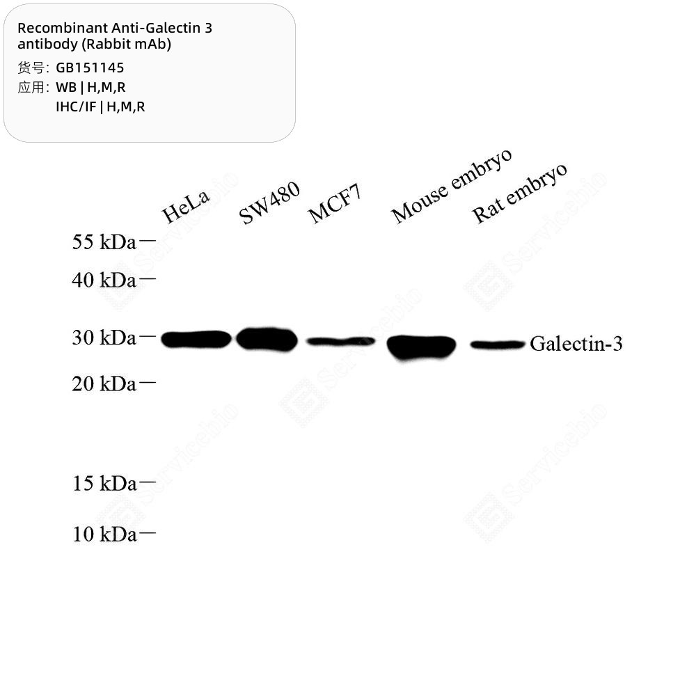 Recombinant Anti-Galectin 3 antibody (Rabbit mAb)
