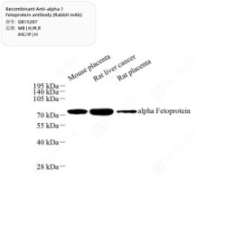 Recombinant Anti-alpha 1 Fetoprotein antibody (Rabbit mAb)