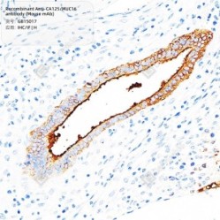 Recombinant Anti-CA125/MUC16 antibody (Mouse mAb)