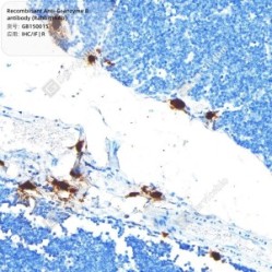 Recombinant Anti-Granzyme B antibody (Rabbit mAb)