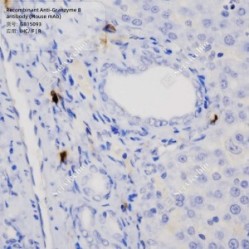 Recombinant Anti-Granzyme B antibody (Mouse mAb)