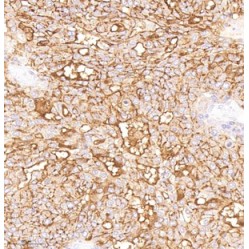 Anti-MUC16 Mouse mAb