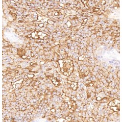 Anti-MUC16 Mouse mAb