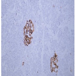 Anti-Chromogranin A Mouse mAb