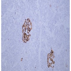 Anti-Chromogranin A Mouse mAb