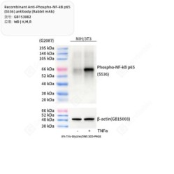 Recombinant Anti-Phospho-NF-kB p65 (S536) antibody (Rabbit mAb)
