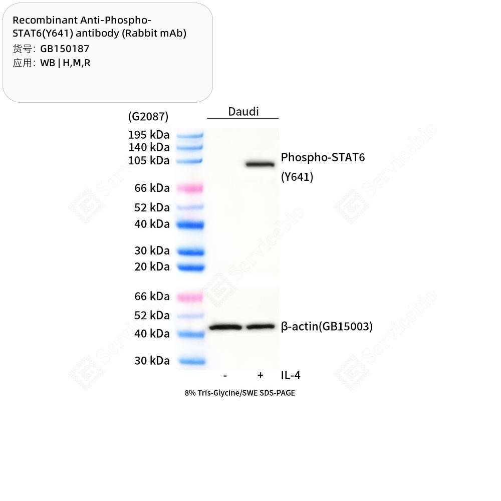Recombinant Anti-Phospho-STAT6(Y641) antibody (Rabbit mAb)