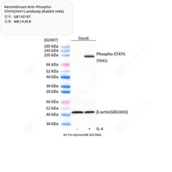 Recombinant Anti-Phospho-STAT6(Y641) antibody (Rabbit mAb)