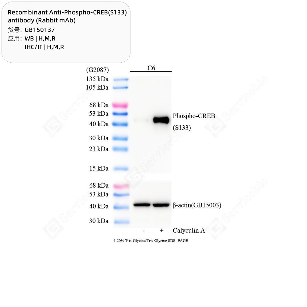 Recombinant Anti-Phospho-CREB(S133) antibody (Rabbit mAb)