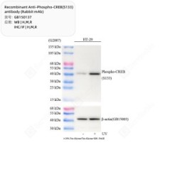 Recombinant Anti-Phospho-CREB(S133) antibody (Rabbit mAb)