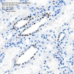 Recombinant Anti-Phospho-CREB(S133) antibody (Rabbit mAb)