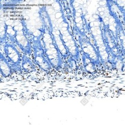 Recombinant Anti-Phospho-CREB(S133) antibody (Rabbit mAb)