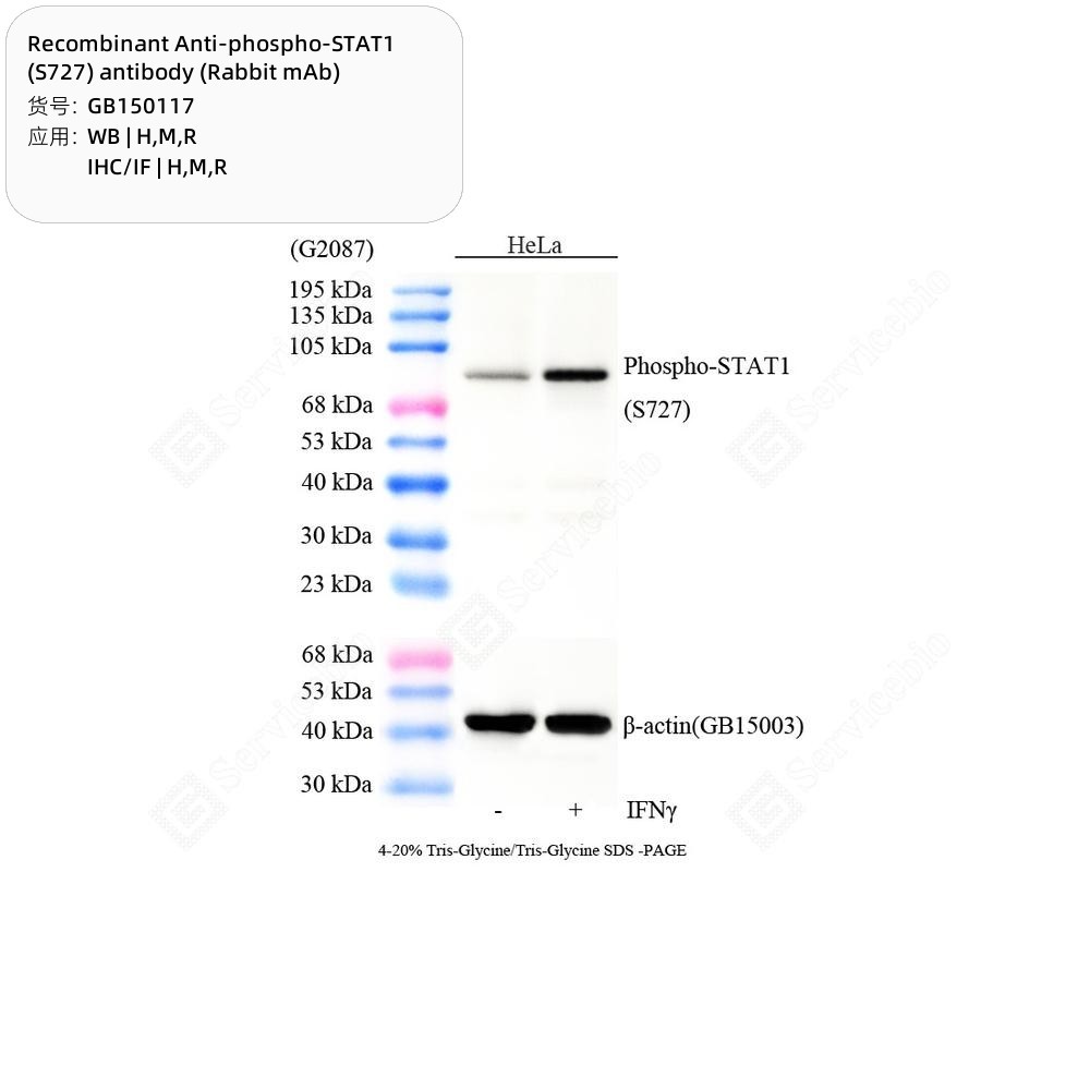 Recombinant Anti-phospho-STAT1 (S727) antibody (Rabbit mAb)
