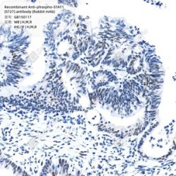 Recombinant Anti-phospho-STAT1 (S727) antibody (Rabbit mAb)