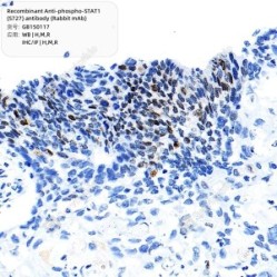Recombinant Anti-phospho-STAT1 (S727) antibody (Rabbit mAb)