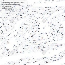 Recombinant Anti-phospho-STAT1 (S727) antibody (Rabbit mAb)