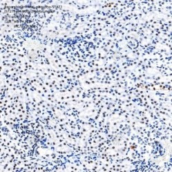 Recombinant Anti-phospho-STAT1 (S727) antibody (Rabbit mAb)