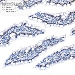 Recombinant Anti-phospho-STAT1 (S727) antibody (Rabbit mAb)