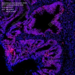 Recombinant Anti-phospho-STAT1 (S727) antibody (Rabbit mAb)