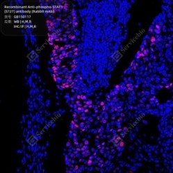Recombinant Anti-phospho-STAT1 (S727) antibody (Rabbit mAb)
