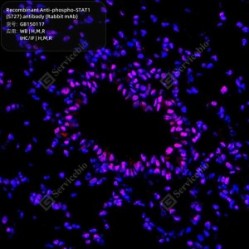 Recombinant Anti-phospho-STAT1 (S727) antibody (Rabbit mAb)