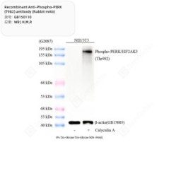 Recombinant Anti-Phospho-PERK (T982) antibody (Rabbit mAb)