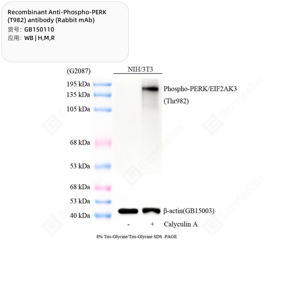 Recombinant Anti-Phospho-PERK (T982) antibody (Rabbit mAb)