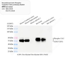 Recombinant Anti-Phospho-Tau(S202/T205) antibody (Rabbit mAb)