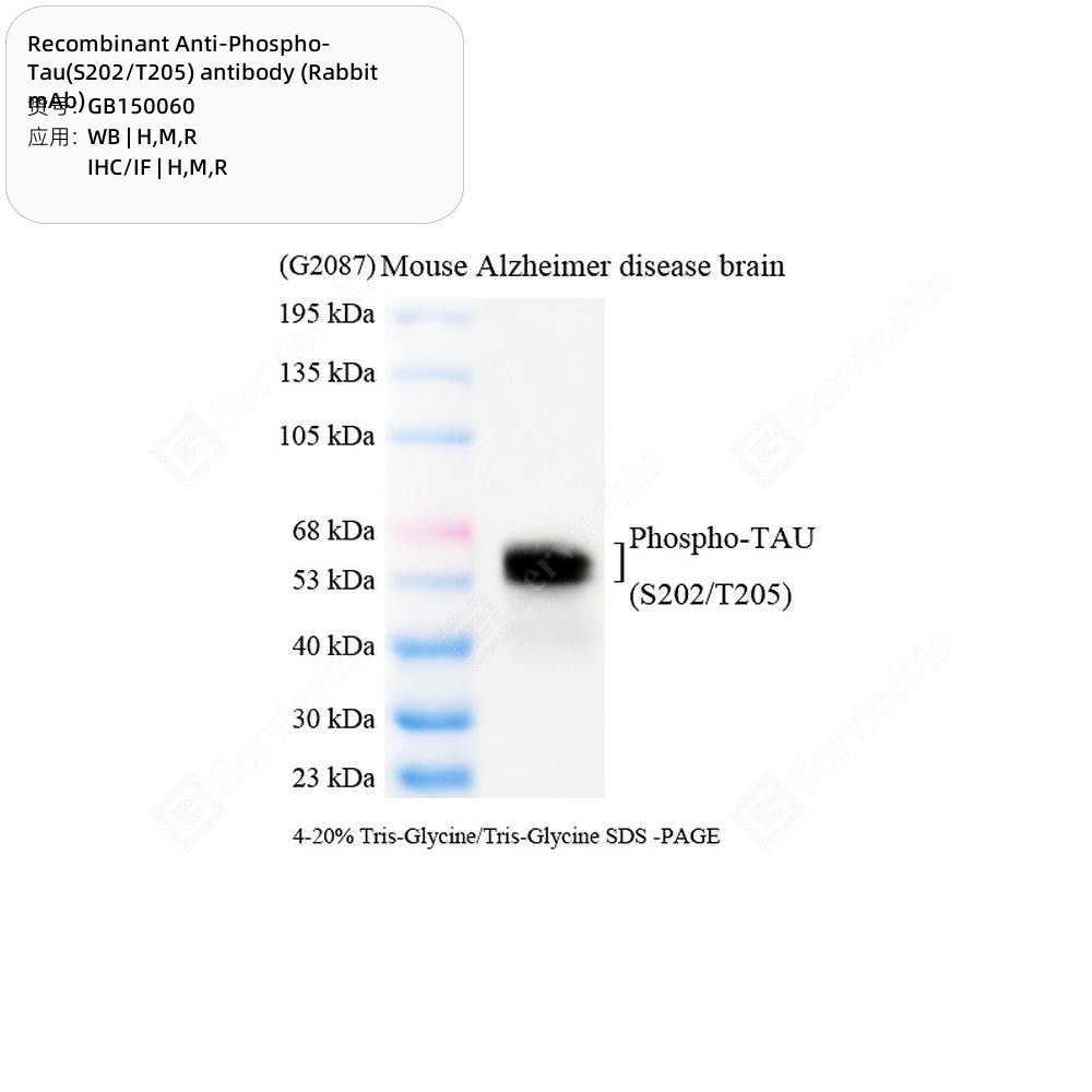 Recombinant Anti-Phospho-Tau(S202/T205) antibody (Rabbit mAb)