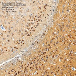 Recombinant Anti-Phospho-Tau(S202/T205) antibody (Rabbit mAb)