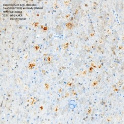 Recombinant Anti-Phospho-Tau(S202/T205) antibody (Rabbit mAb)