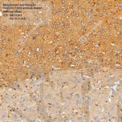 Recombinant Anti-Phospho-Tau(S202/T205) antibody (Rabbit mAb)